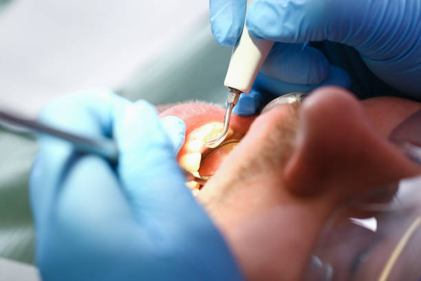 Best Emergency Dental Services for Seniors in North Springfield, VA