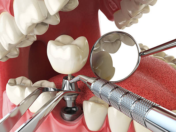Best Mobile Emergency Dentist in North Springfield, VA